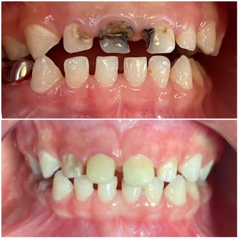 Treating kids' teeth to a high standard